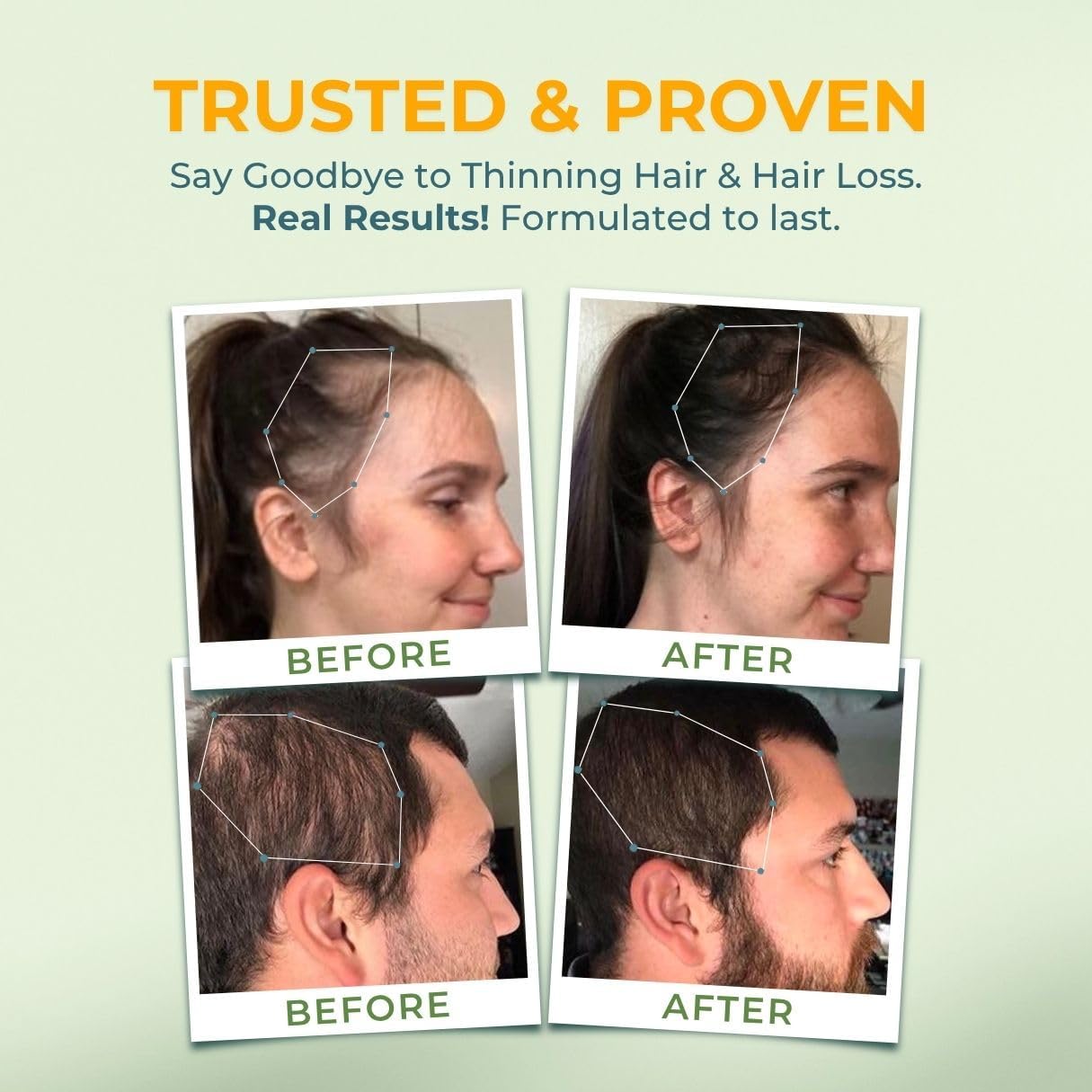 Vital Nutritive Vital Hair Complex – Hair Growth, Skin & Nails  supplement (60 Capsules))